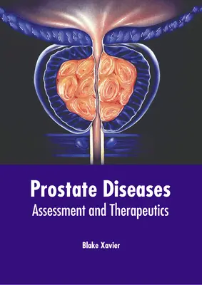 Maladies de la prostate : Évaluation et thérapeutique - Prostate Diseases: Assessment and Therapeutics