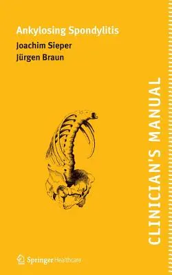 Manuel du clinicien sur la spondylarthrite ankylosante - Clinician's Manual on Ankylosing Spondylitis