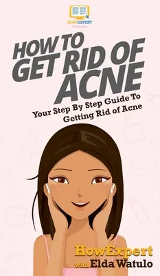 Comment se débarrasser de l'acné : Votre guide pas à pas pour vous débarrasser de l'acné - How To Get Rid of Acne: Your Step By Step Guide To Getting Rid of Acne