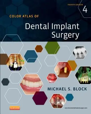 Atlas en couleur de la chirurgie des implants dentaires - Color Atlas of Dental Implant Surgery