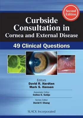 La consultation de proximité en cornée et maladies externes : 49 questions cliniques - Curbside Consultation in Cornea and External Disease: 49 Clinical Questions