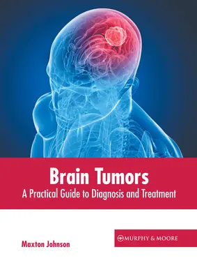 Les tumeurs cérébrales : Guide pratique du diagnostic et du traitement - Brain Tumors: A Practical Guide to Diagnosis and Treatment