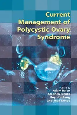 Prise en charge actuelle du syndrome des ovaires polykystiques - Current Management of Polycystic Ovary Syndrome