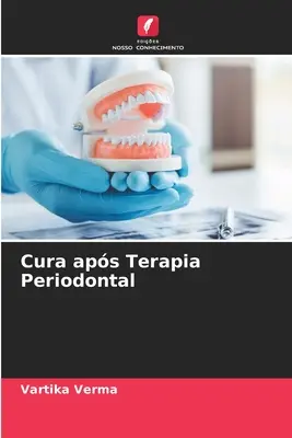 Cura aps Terapia Periodontal