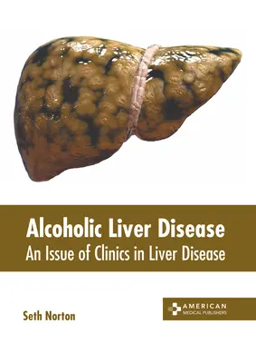 La maladie alcoolique du foie : Un numéro de Clinics in Liver Disease - Alcoholic Liver Disease: An Issue of Clinics in Liver Disease