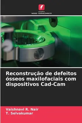 Reconstruire les déficits des sols maxilofaciaux à l'aide de dispositifs Cad-Cam - Reconstruo de defeitos sseos maxilofaciais com dispositivos Cad-Cam