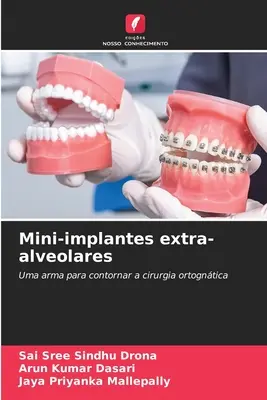 Mini-implants extra-alvéolaires - Mini-implantes extra-alveolares