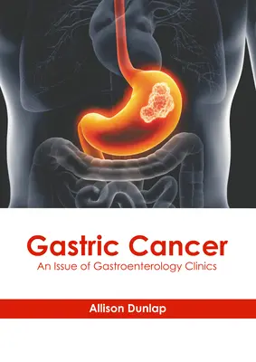Cancer de l'estomac : Un numéro de Gastroenterology Clinics - Gastric Cancer: An Issue of Gastroenterology Clinics
