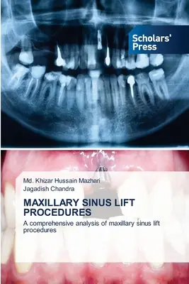 Procédures de lifting des sinus maxillaires - Maxillary Sinus Lift Procedures
