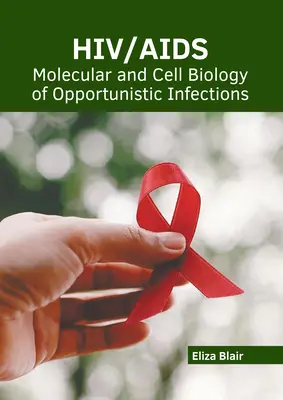 Hiv/Aids : Biologie moléculaire et cellulaire des infections opportunistes - Hiv/Aids: Molecular and Cell Biology of Opportunistic Infections