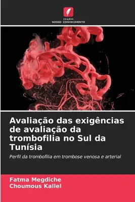 Évaluation des exigences de l'évaluation de la trombophilie dans le sud de la Tunisie - Avaliao das exigncias de avaliao da trombofilia no Sul da Tunsia