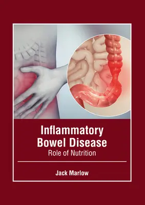 Les maladies inflammatoires de l'intestin : Rôle de la nutrition - Inflammatory Bowel Disease: Role of Nutrition