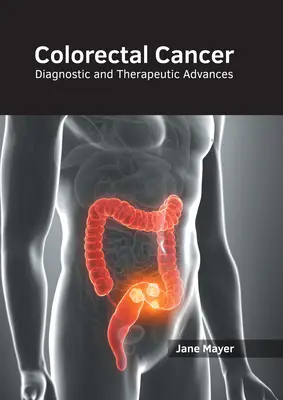 Le cancer colorectal : Avancées diagnostiques et thérapeutiques - Colorectal Cancer: Diagnostic and Therapeutic Advances
