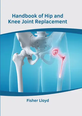 Manuel sur l'arthroplastie de la hanche et du genou - Handbook of Hip and Knee Joint Replacement