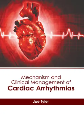 Mécanisme et gestion clinique des arythmies cardiaques - Mechanism and Clinical Management of Cardiac Arrhythmias