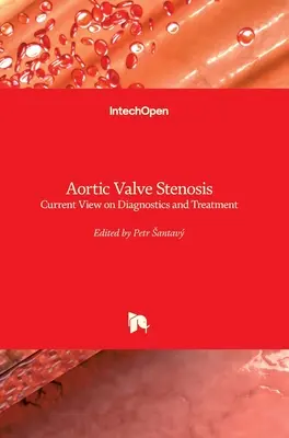 Sténose valvulaire aortique : Le point de vue actuel sur le diagnostic et le traitement - Aortic Valve Stenosis: Current View on Diagnostics and Treatment