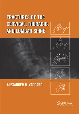 Fractures de la colonne cervicale, thoracique et lombaire - Fractures of the Cervical, Thoracic, and Lumbar Spine