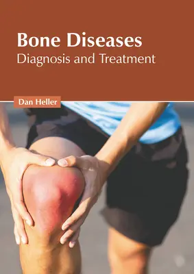 Maladies osseuses : Diagnostic et traitement - Bone Diseases: Diagnosis and Treatment