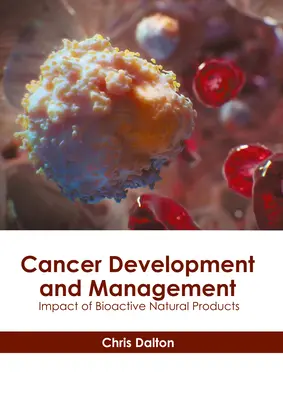 Développement et gestion du cancer : Impact des produits naturels bioactifs - Cancer Development and Management: Impact of Bioactive Natural Products