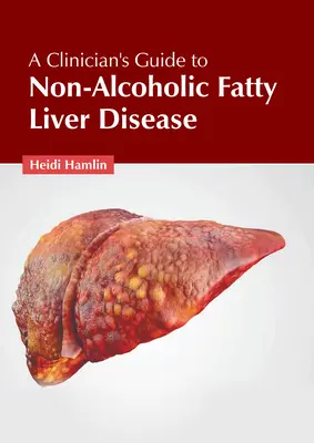 Guide du clinicien sur la maladie du foie gras non alcoolique - A Clinician's Guide to Non-Alcoholic Fatty Liver Disease