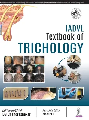 Manuel de trichologie de l'IADVL - IADVL Textbook of Trichology