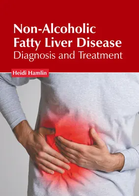 La maladie du foie gras non alcoolique : Diagnostic et traitement - Non-Alcoholic Fatty Liver Disease: Diagnosis and Treatment