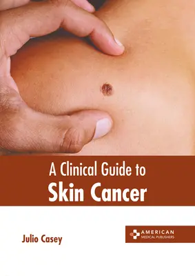 Guide clinique du cancer de la peau - A Clinical Guide to Skin Cancer
