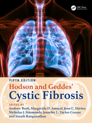 La fibrose kystique selon Hodson et Geddes - Hodson and Geddes' Cystic Fibrosis