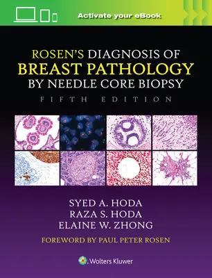 Rosen's Diagnosis of Breast Pathology by Needle Core Biopsy (Diagnostic de la pathologie mammaire par biopsie à l'aiguille) - Rosen's Diagnosis of Breast Pathology by Needle Core Biopsy