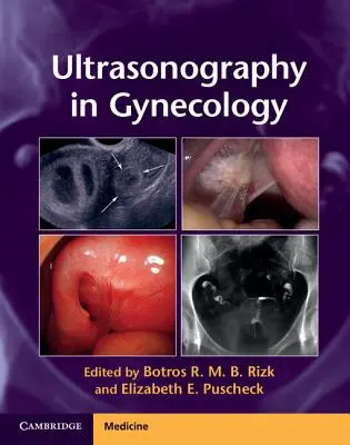 L'échographie en gynécologie - Ultrasonography in Gynecology