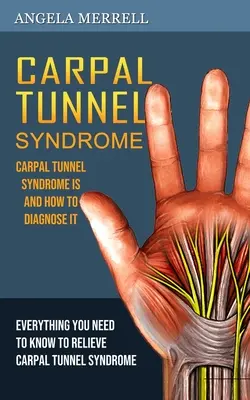 Syndrome du canal carpien : Le syndrome du canal carpien : ce qu'il est et comment le diagnostiquer - Carpal Tunnel Syndrome: Carpal Tunnel Syndrome is and How to Diagnose It