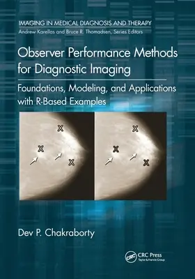 Méthodes de performance des observateurs pour l'imagerie diagnostique : Fondations, modélisation et applications avec des exemples basés sur R - Observer Performance Methods for Diagnostic Imaging: Foundations, Modeling, and Applications with R-Based Examples