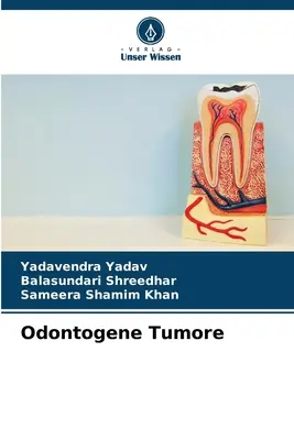 Tumeur odontogène - Odontogene Tumore