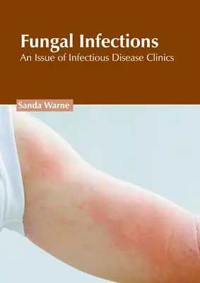 Infections fongiques : Un numéro de Infectious Disease Clinics - Fungal Infections: An Issue of Infectious Disease Clinics