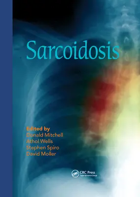 La sarcoïdose - Sarcoidosis