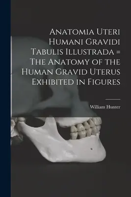 Anatomia Uteri Humani Gravidi Tabulis Illustrada = L'anatomie de l'utérus humain gravide exposée en figures - Anatomia Uteri Humani Gravidi Tabulis Illustrada = The Anatomy of the Human Gravid Uterus Exhibited in Figures