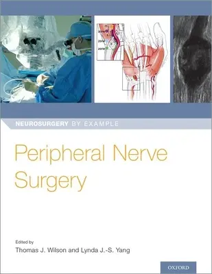 Chirurgie des nerfs périphériques - Peripheral Nerve Surgery