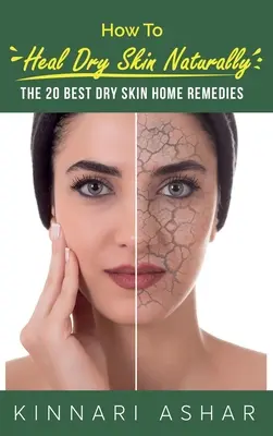 Comment guérir la peau sèche naturellement : Les 20 meilleurs remèdes maison pour la peau sèche - How to Heal Dry Skin Naturally: The 20 Best Dry Skin Home Remedies
