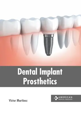 Prothèses d'implants dentaires - Dental Implant Prosthetics