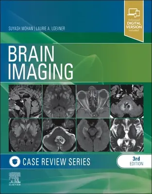 Examen de cas d'imagerie cérébrale - Brain Imaging Case Review