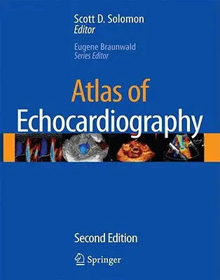 Atlas de l'échocardiographie [avec CDROM] - Atlas of Echocardiography [With CDROM]