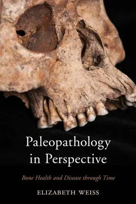 La paléopathologie en perspective : La santé et la maladie des os à travers le temps - Paleopathology in Perspective: Bone Health and Disease through Time