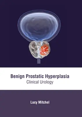 Hyperplasie bénigne de la prostate : Urologie clinique - Benign Prostatic Hyperplasia: Clinical Urology