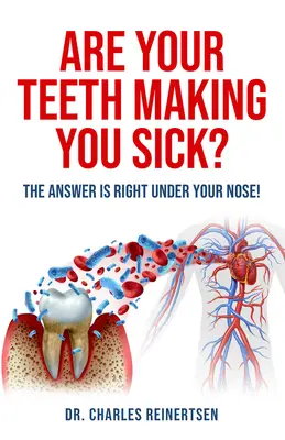 Vos dents vous rendent malades : la réponse est sous votre nez - Are Your Teeth Making You Sick?: The Answer Is Right Under Your Nose