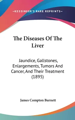 Les maladies du foie : La jaunisse, les calculs biliaires, les hypertrophies, les tumeurs et le cancer, et leur traitement (1895) - The Diseases Of The Liver: Jaundice, Gallstones, Enlargements, Tumors And Cancer, And Their Treatment (1895)