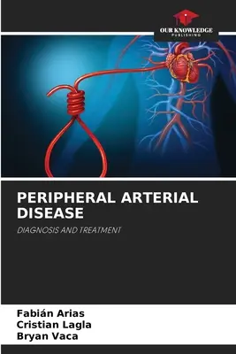 Maladie artérielle périphérique - Peripheral Arterial Disease