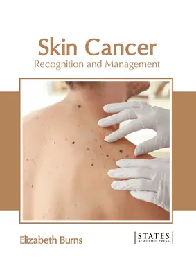 Le cancer de la peau : Reconnaissance et prise en charge - Skin Cancer: Recognition and Management