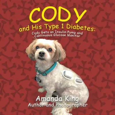 Cody et son diabète de type 1 : Cody reçoit une pompe à insuline et un moniteur de glucose continu - Cody and His Type 1 Diabetes: Cody Gets an Insulin Pump and Continuous Glucose Monitor