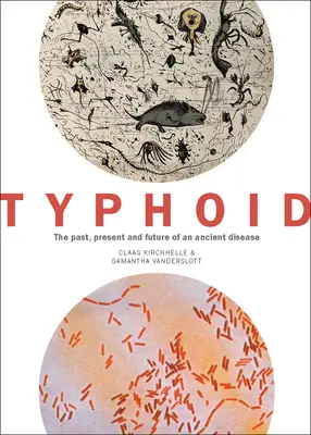 Typhoïde : Le passé, le présent et l'avenir d'une maladie ancienne - Typhoid: The Past, Present, and Future of an Ancient Disease