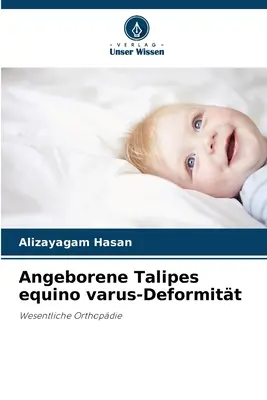 Angeborene Talipes equino varus-Deformitt